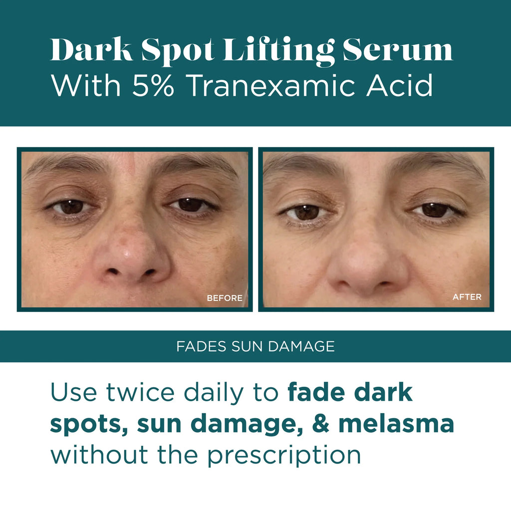 VI Peel Dark Spot Lifting Serum
