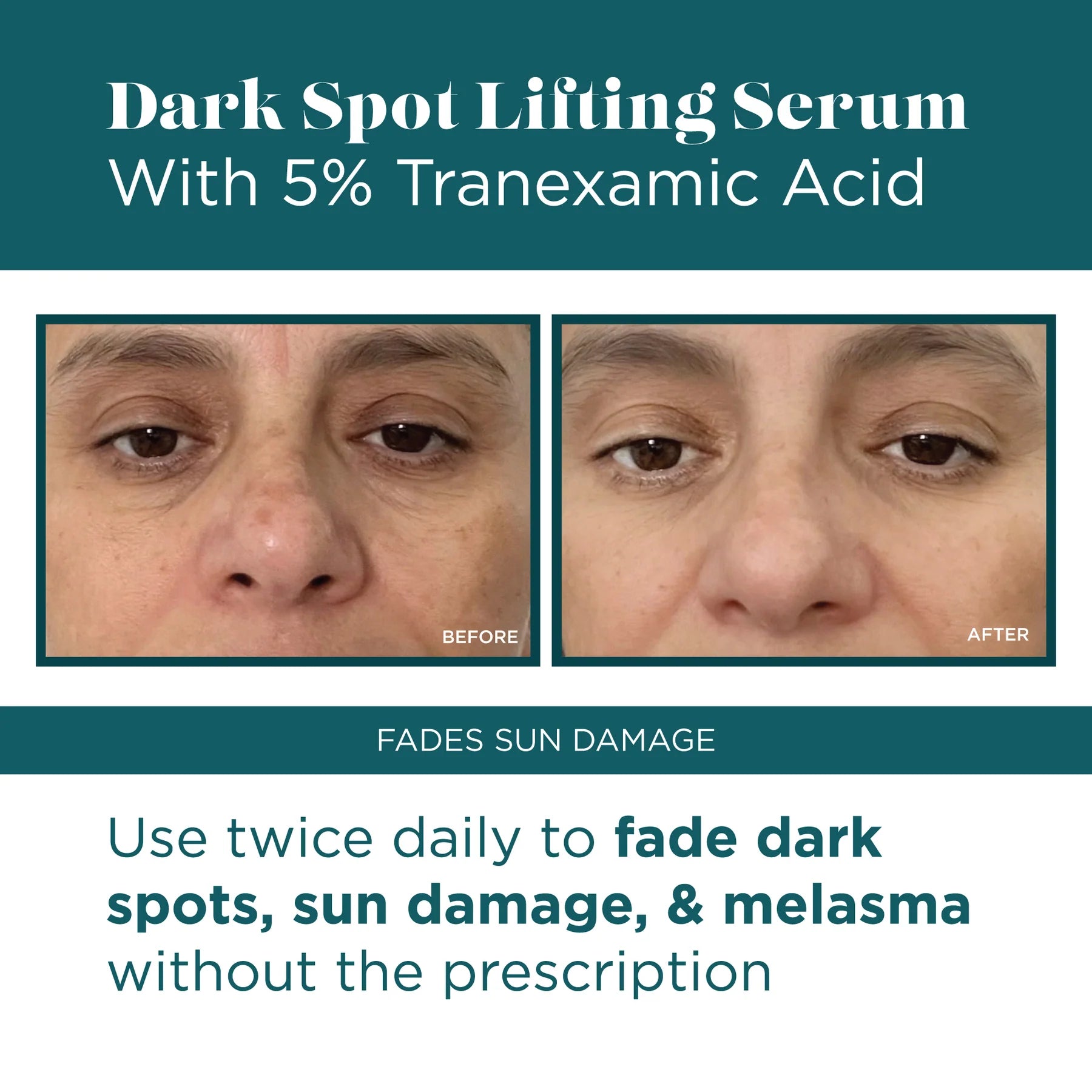 VI Peel Dark Spot Lifting Serum